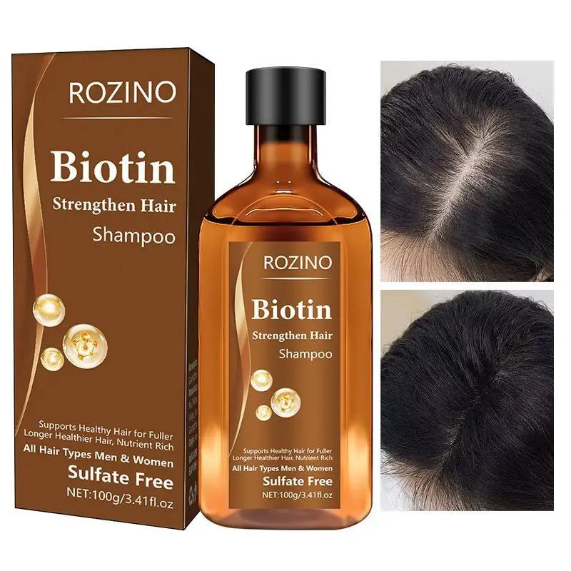 Biotin Hair Growth Shampoo – Anti Hair Loss & Anti-Dandruff Treatment