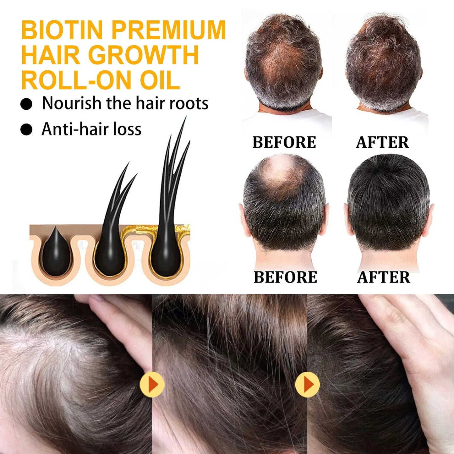 Biotin Hair Growth – Anti Hair Loss Serum for Men & Women