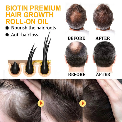 Biotin Hair Growth – Anti Hair Loss Serum for Men & Women