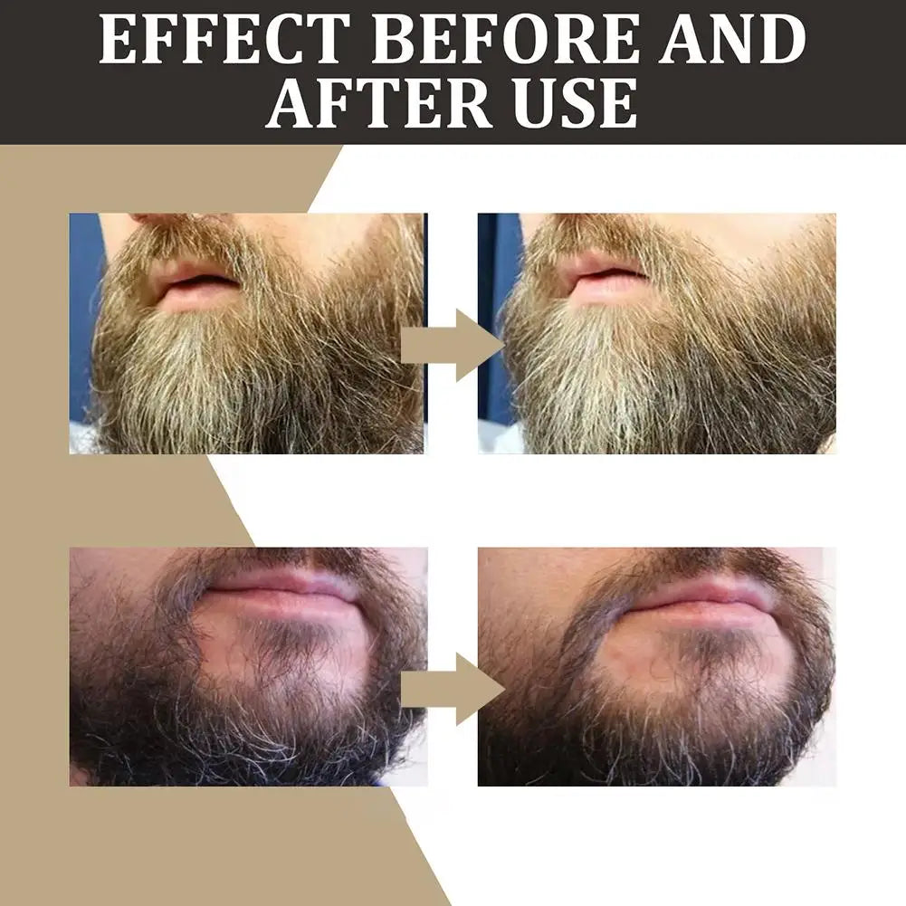 Natural Beard Growth Oil for Men 30ml