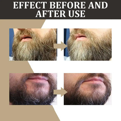 Natural Beard Growth Oil for Men 30ml