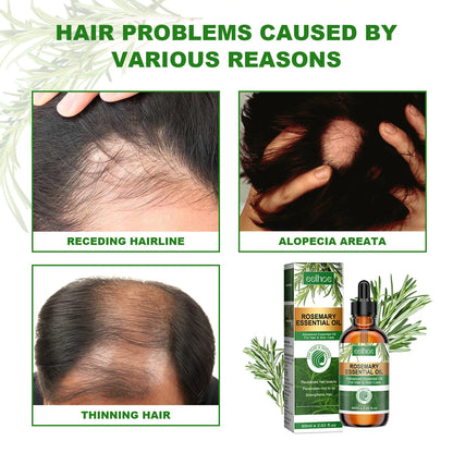 Rosemary Hair Growth Serum 60ml / 120ml