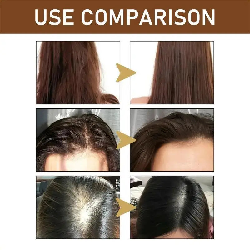 Biotin Hair Growth Shampoo – Anti Hair Loss & Anti-Dandruff Treatment