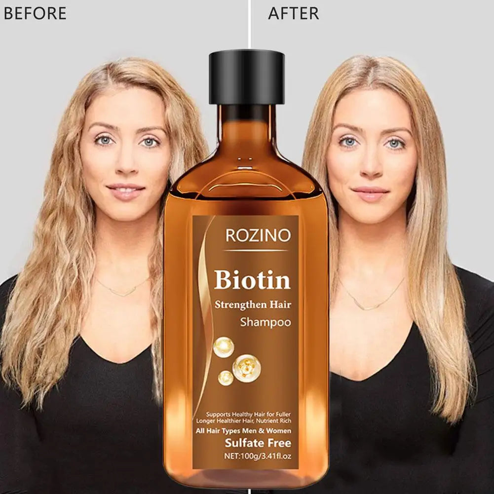 Biotin Hair Growth Shampoo – Anti Hair Loss & Anti-Dandruff Treatment