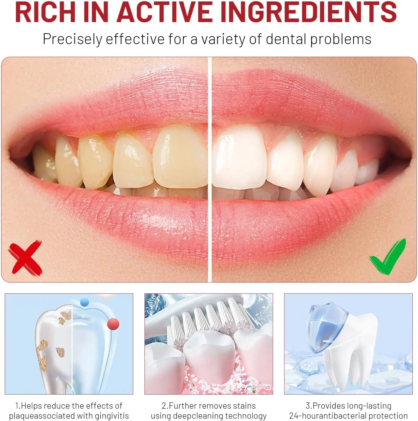 Niacinamide Whitening Toothpaste – Removes Stains, Whitens & Protects Teeth