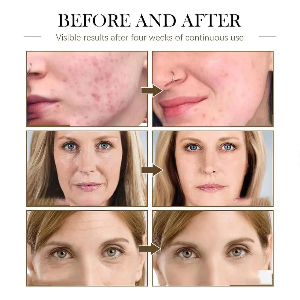Rosehip, Black Seed & Castor Oil Face Serum 100% Natural 30ml